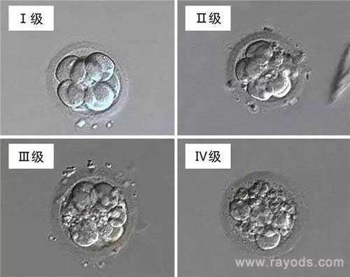 阿拉善盟正规代孕公司排名_阿拉善盟代孕机构代孕过程_试管婴儿胚胎等级代表
